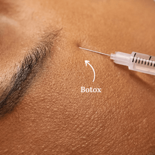 Injections d'acide hyaluronique ou de botox - Labote