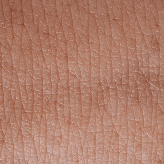 Comment mieux gérer les poussées de psoriasis naturellement ? - Labote